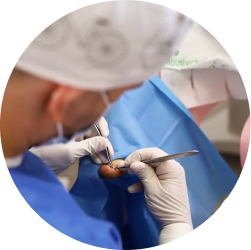 Podochirurgia – plastyka wałów i guzowatości opuszka