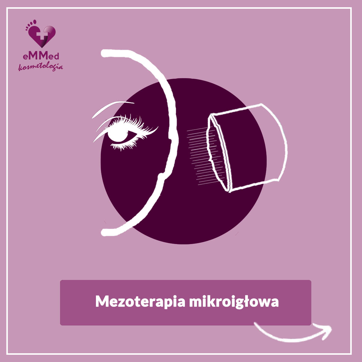 Mezoterapia mikroigłowa